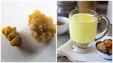 Tè di zenzero e curcuma per combattere i calcoli renali