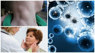 Linfoma: tumore silenzioso curato grazie alla diagnosi precoce