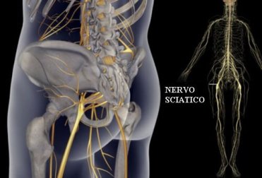 Esercizi per dolori al nervo sciatico, bacino e schiena