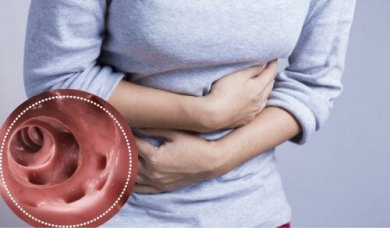 Curare la diverticolite con gli alimenti giusti