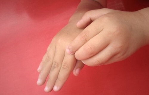 eliminare lo stress con le mani