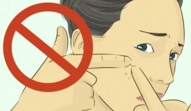 Schiacciare i brufoli: perché non bisogna mai farlo?