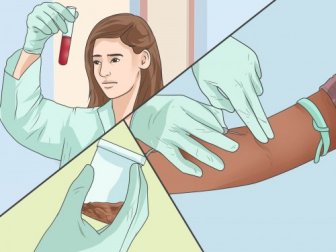 Tumore al colon-retto: 7 sintomi precoci da non ignorare