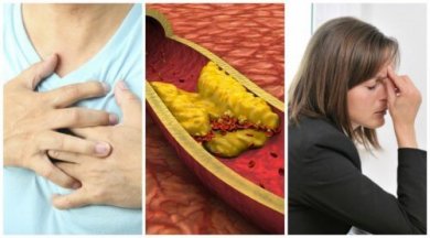 Ipercolesterolemia: 10 sintomi da non ignorare