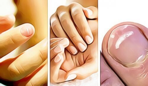 Unghie delle mani, 5 caratteristiche che indicano un problema di salute