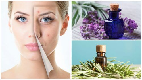 Trattare l'acne con oli essenziali