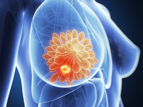 La carne grigliata e il tumore al seno: un fattore di rischio?