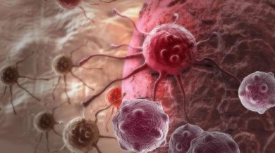 Un nuovo studio suggerisce la possibile causa principale del cancro