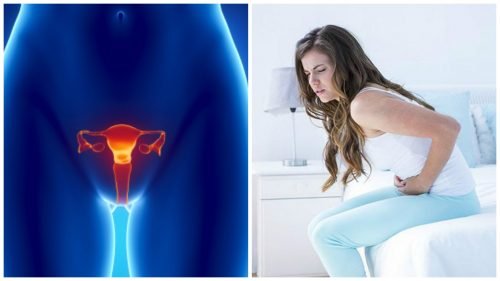 tumore ovaio sintomi ragazza