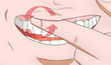 Gengive infiammate: 8 rimedi naturali