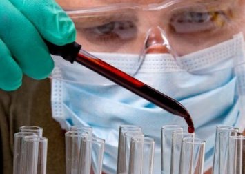 Analisi del sangue e diagnosi dei tumori