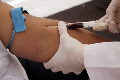 medico esegue prelievo di sangue dal braccio