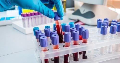 sangue in provette per test clinici