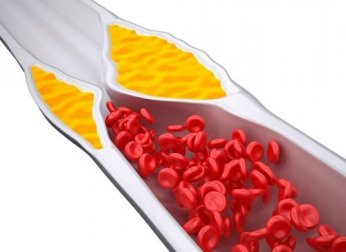 4 frullati per tenere regolare il colesterolo