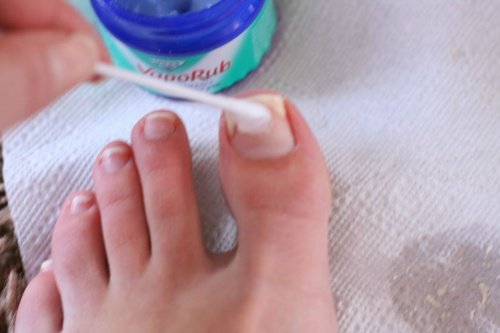 Usi alternativi del Vicks VapoRub sulle unghie dei piedi