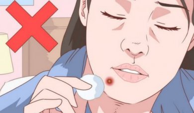 Eliminare l'acne dal mento con un rimedio naturale