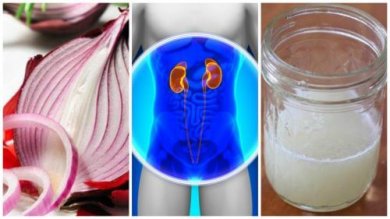 Come preparare un rimedio alla cipolla per depurare i reni