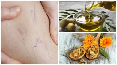 Vene varicose: combatterle con olio d'oliva e calendula