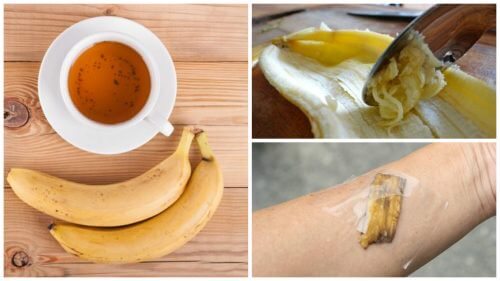 5 modi per utilizzare la buccia di banana come rimedio naturale 5 modi per utilizzare la buccia di banana come rimedio naturale