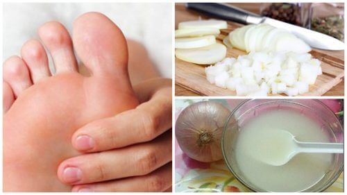 Come liberarsi dei duroni con due ingredienti naturali Come liberarsi dei duroni con due ingredienti naturali
