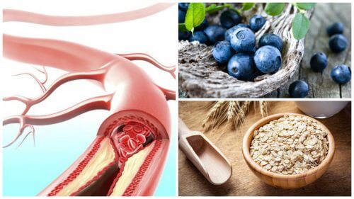 Migliorare la salute arteriosa grazie a 9 alimenti Migliorare la salute arteriosa grazie a 9 alimenti