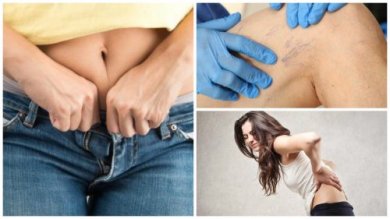 9 problemi di salute causati da indumenti troppo stretti