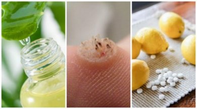 6 efficaci rimedi per eliminare le verruche