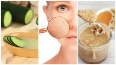 5 rimedi naturali per chiudere i pori dilatati