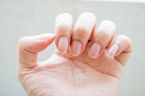 problemi alle unghie delle mani