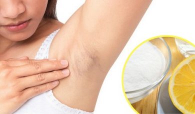 Rimedi naturali per schiarire le ascelle