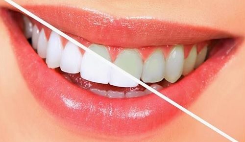 10 alimenti per sbiancare i denti in modo naturale