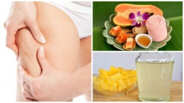 5 rimedi naturali per combattere la cellulite