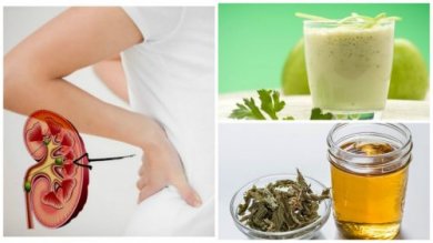 Combattere i calcoli renali con 5 rimedi naturali