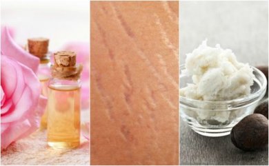 4 trattamenti naturali per le smagliature