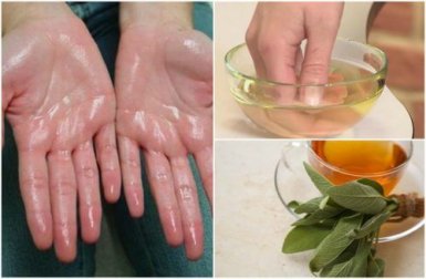 Iperidrosi palmare: 7 rimedi naturali per alleviarla