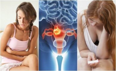 Cos'è il mioma uterino?