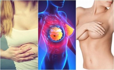 Forme iniziali del tumore al seno: quali sintomi?
