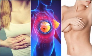 Forme iniziali del tumore al seno: quali sintomi?