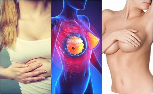 Forme iniziali del tumore al seno: quali sintomi?
