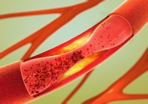 Migliori alimenti per pulire le arterie