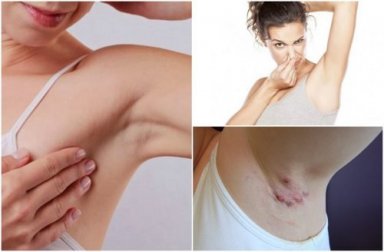 Le ascelle possono indicare un problema di salute