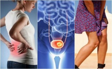 Tumore alla vescica: i sintomi da non sottovalutare