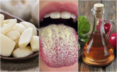 6 rimedi naturali per tenere sotto controllo la candida
