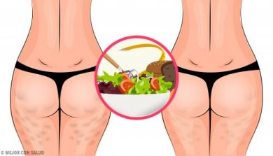 Come eliminare la cellulite con una dieta sana