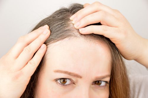Erbe e spezie che stimolano la crescita dei capelli Erbe e spezie che stimolano la crescita dei capelli