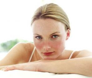 Domande frequenti sul lupus