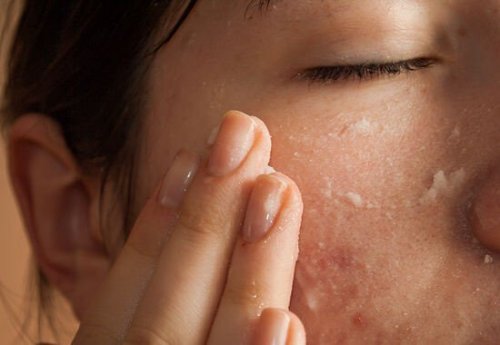 Maschera di bicarbonato di sodio