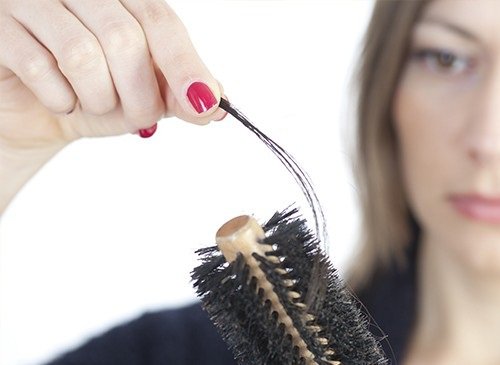 Ragazza che perde i capelli