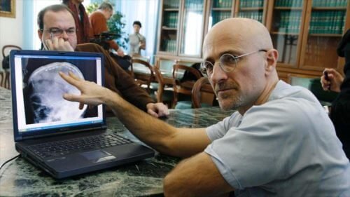 Chirurgo trapianto di testa