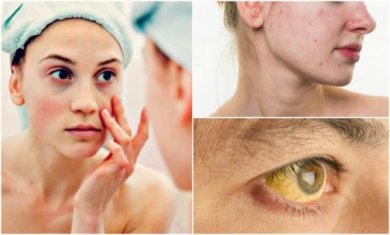 Deficit nutrizionali: 7 reazioni cutanee